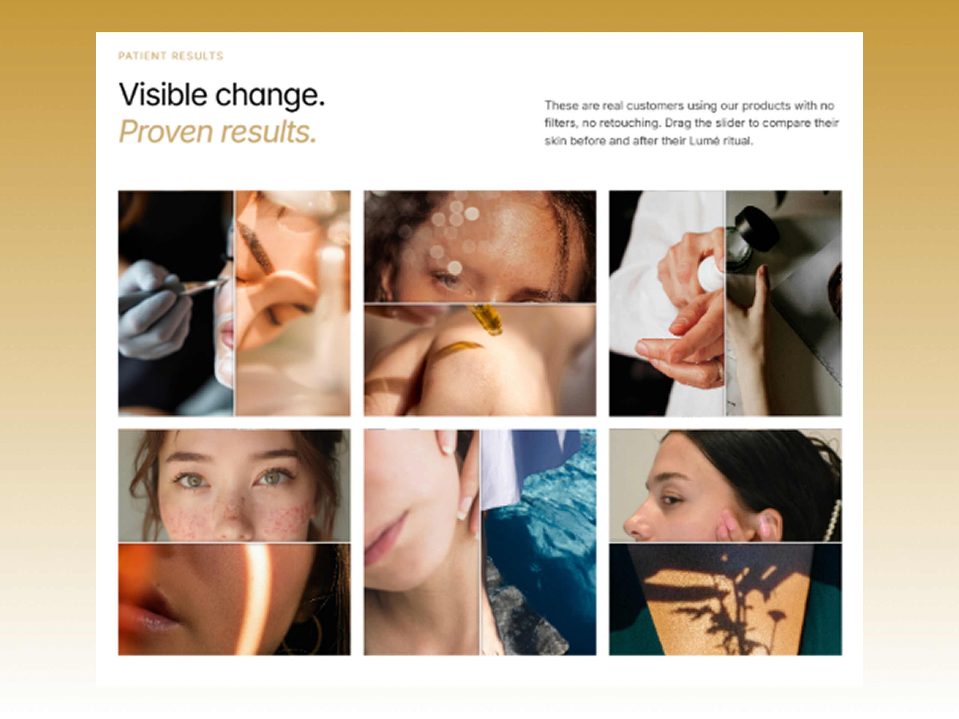 Screenshot 4 of Lumeo — Skincare